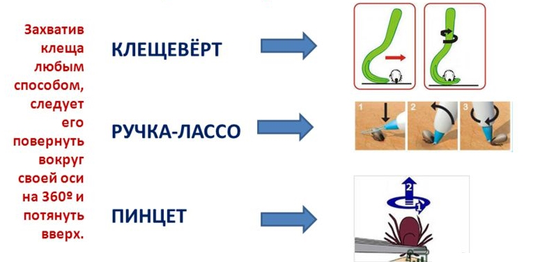 Удаление клеща. Клещеверт. Ручка лассо от клещей. Удаление клеща ручкой лассо. Как вытащить клеща приспособлением.
